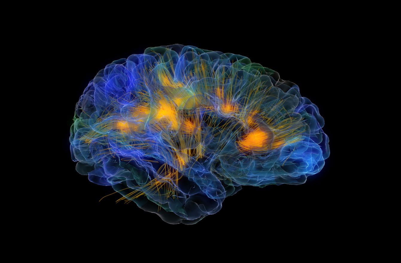 « Le cerveau transparent »